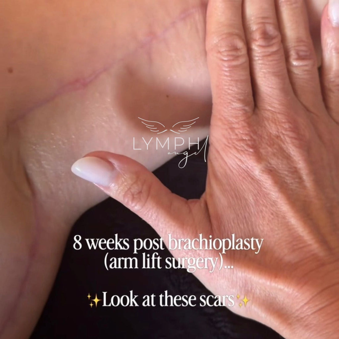 Recovery Starts Before Surgery: Why Preparation Matters More Than Most People Realise